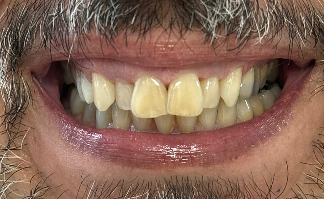 Multidisciplinary Dentistry Before & After