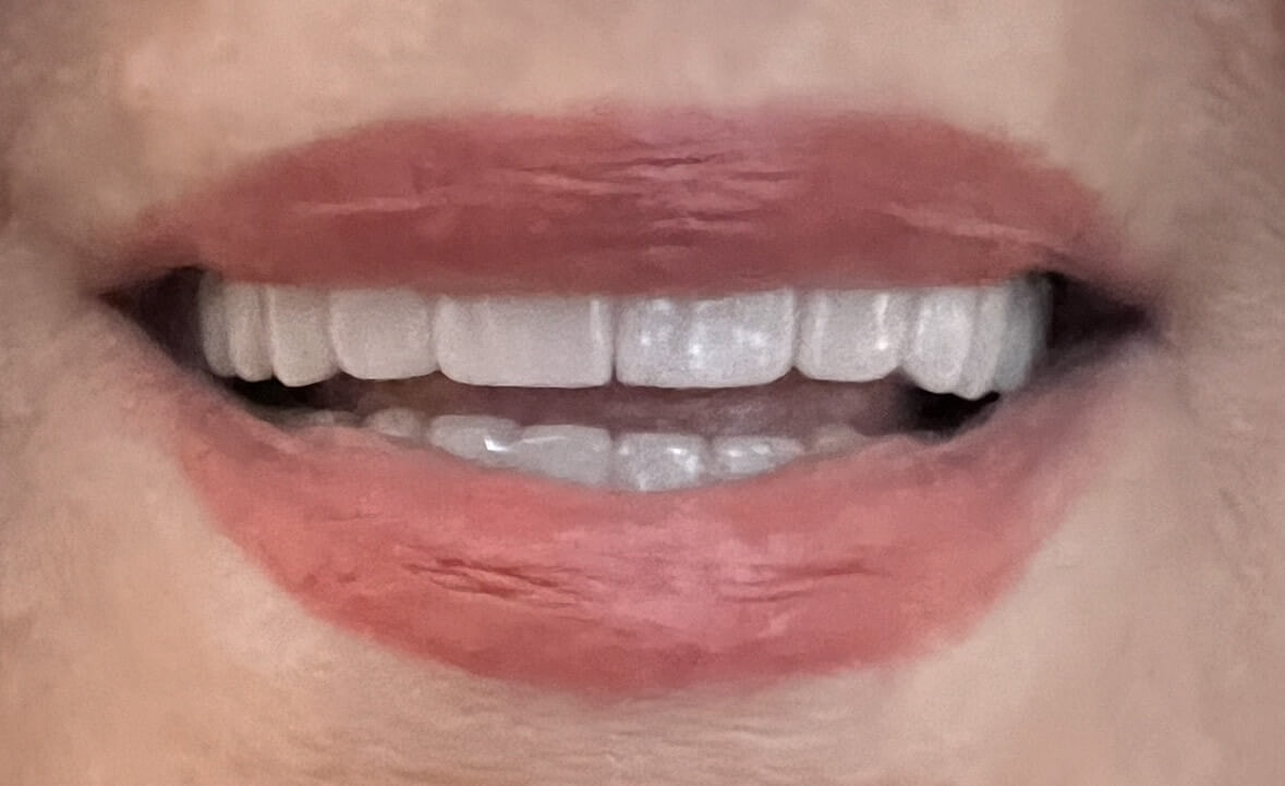 Multidisciplinary Dentistry Before & After