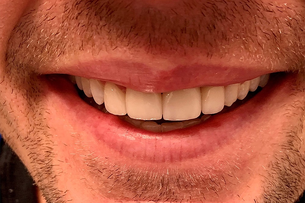 Trauma Treatment Before & After